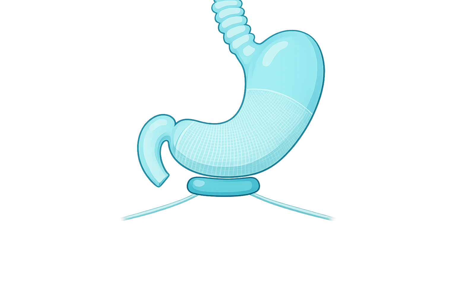 Reflux Surgery icon